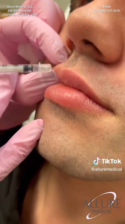 A close-up of a person receiving a lip injection administered by a gloved professional. Text on the image indicates it's from Allure Medical in Charlotte, NC, specializing in Botox treatments.