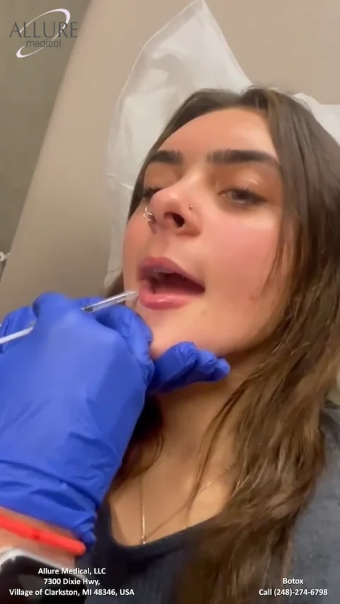 A person receives a Botox injection in their lips at Allure Medical, LLC. The practitioner's gloved hand is holding the needle. Contact details of the clinic are visible.