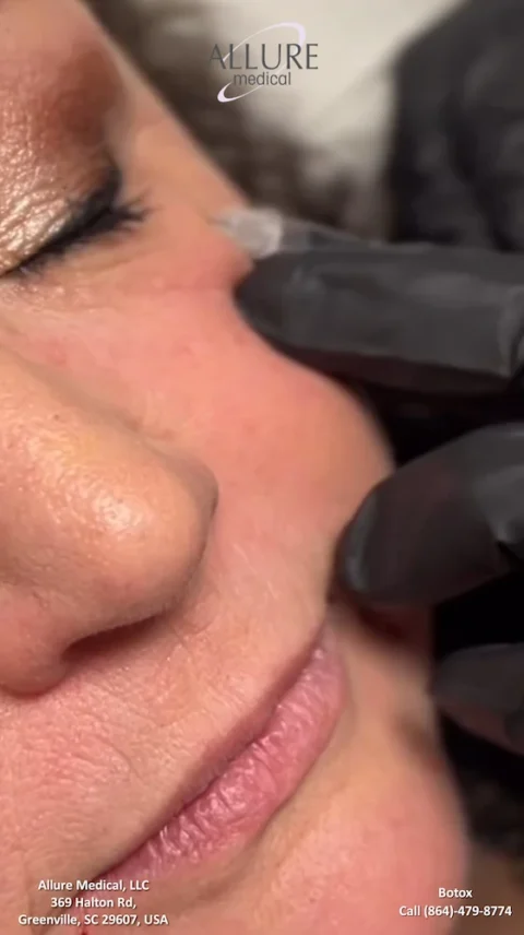 A close-up of a medical professional injecting Botox into a patient's face. The image includes the name Allure Medical, LLC, address, and phone number.