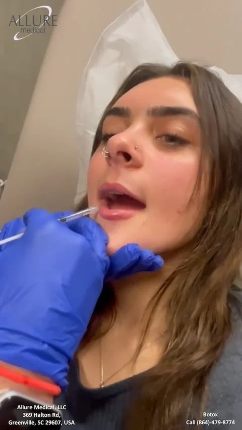 Person receiving a cosmetic injection in the lip area at Allure Medical, LLC. Contact information displayed for Botox services.