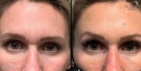 Two side-by-side close-up photos of a woman's eyes. The left image shows her eyelashes without mascara, and the right image shows her eyelashes with mascara applied.