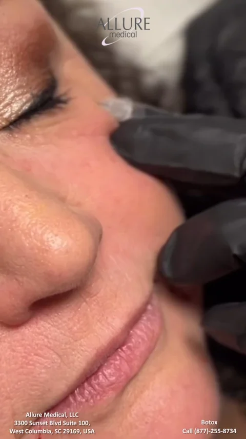 Close-up of a person receiving a Botox injection near the eye, administered by a gloved professional. Text on the image provides business name, address, and contact details of Allure Medical, LLC.