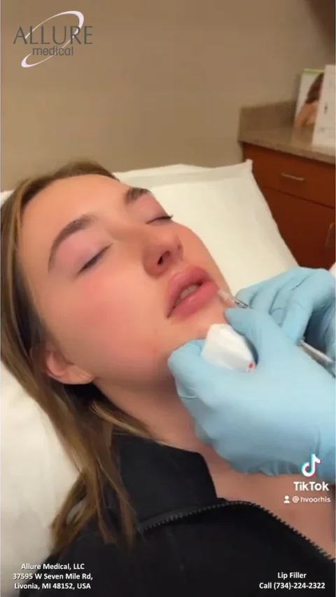 A person receives a lip filler injection by a gloved professional. The image shows the procedure being performed in a medical setting with branding for Allure Medical and contact information visible.