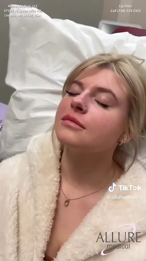 A woman with blonde hair lies down with her eyes closed. She is wearing a white robe. Text on image includes contact information for Allure Medical and mentions "Lip Filler." TikTok and Allure Medical logos.