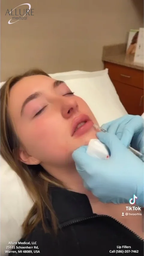 A person receiving a lip filler injection from a professional in a medical setting. Office details and contact information for Allure Medical, LLC, are visible, along with a TikTok username "hvoorthis".