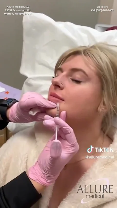 A woman is receiving a lip filler injection from a professional wearing pink gloves at Allure Medical in Warren, MI. The facility's contact information is visible.