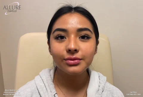 A young woman with a neutral expression sits in a medical office. The background includes the Allure Medical logo and contact information.