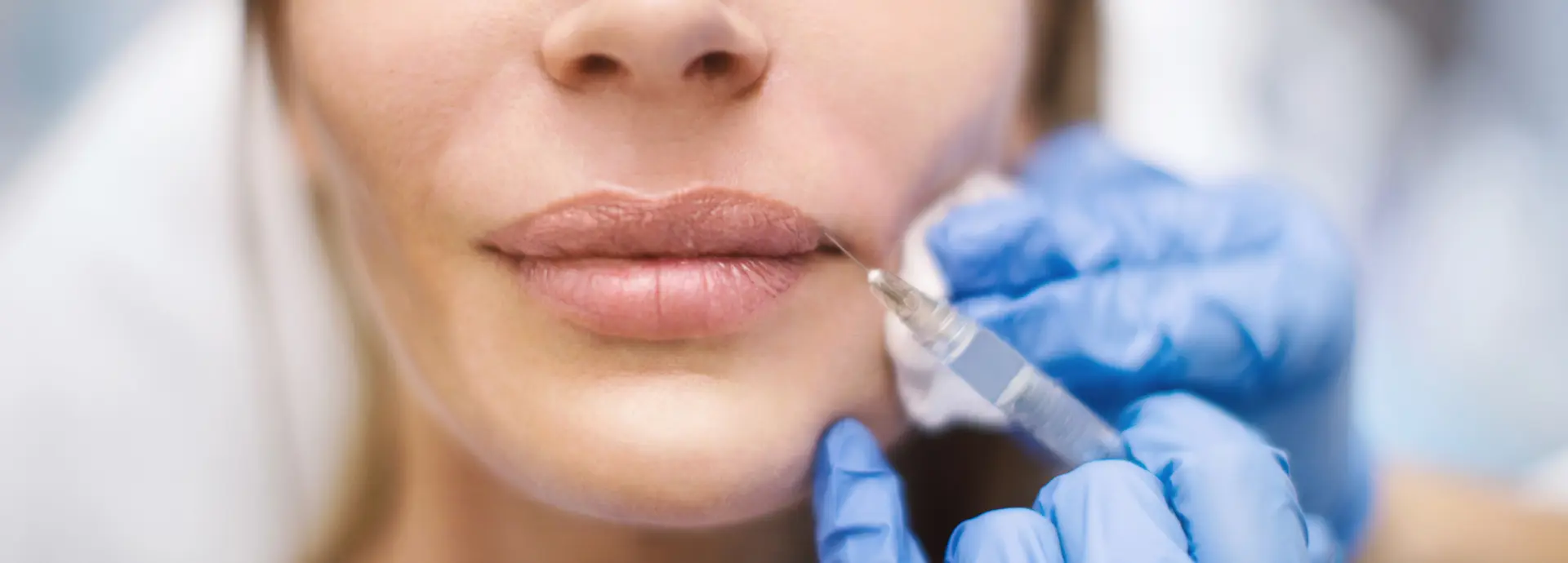 Close-up of a person receiving a lip filler injection administered by a professional wearing blue gloves.
