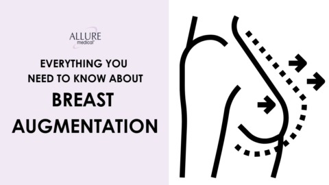 A promotional graphic by Allure Medical detailing breast augmentation, featuring a diagram of a breast with arrows indicating augmentation areas.