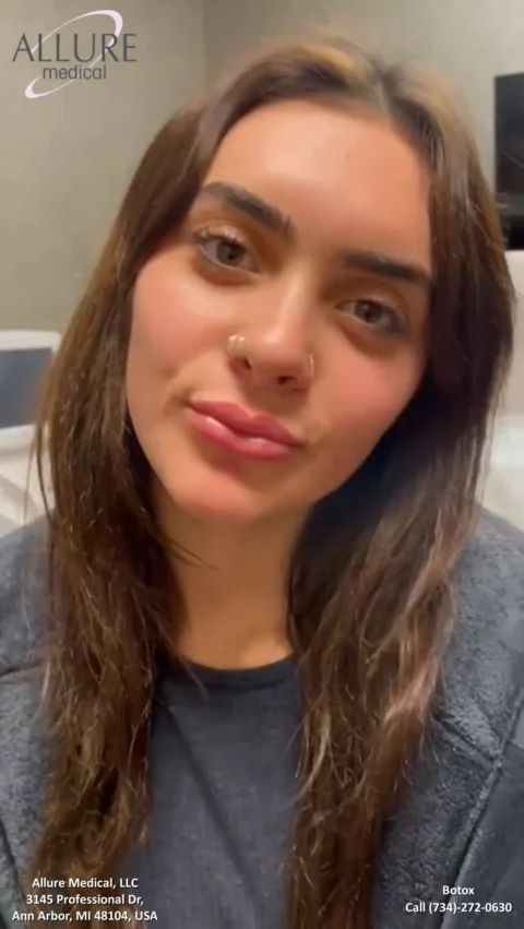 A person with long brown hair and a nose ring looks into the camera, background shows interior setting. Allure Medical logo and contact information are visible. Text mentions Botox.