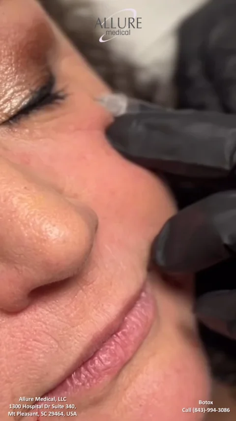 A close-up of a person receiving a Botox injection near their eye from a gloved hand. The Allure Medical logo is visible at the top. Contact details are at the bottom.