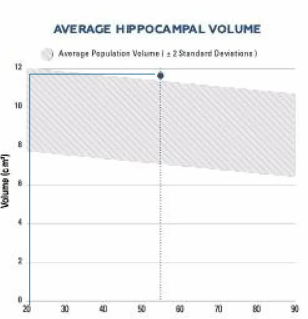 Graph showing average hippocampal volume. X-axis: Age (20-90 years), Y-axis: Volume (cm³, 0-12). Shaded area indicates average population volume ±2 standard deviations.