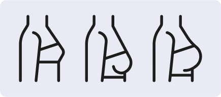 Three line drawings show different breast shapes and positions in profile view, illustrating variations in contour and sagging.