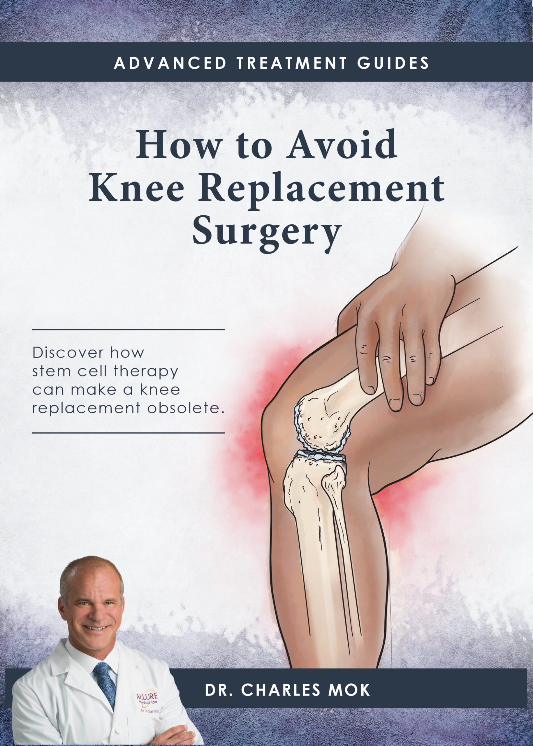 Book cover titled "How to Avoid Knee Replacement Surgery" featuring a knee illustration, a doctor’s photo, and text about stem cell therapy as an alternative treatment.